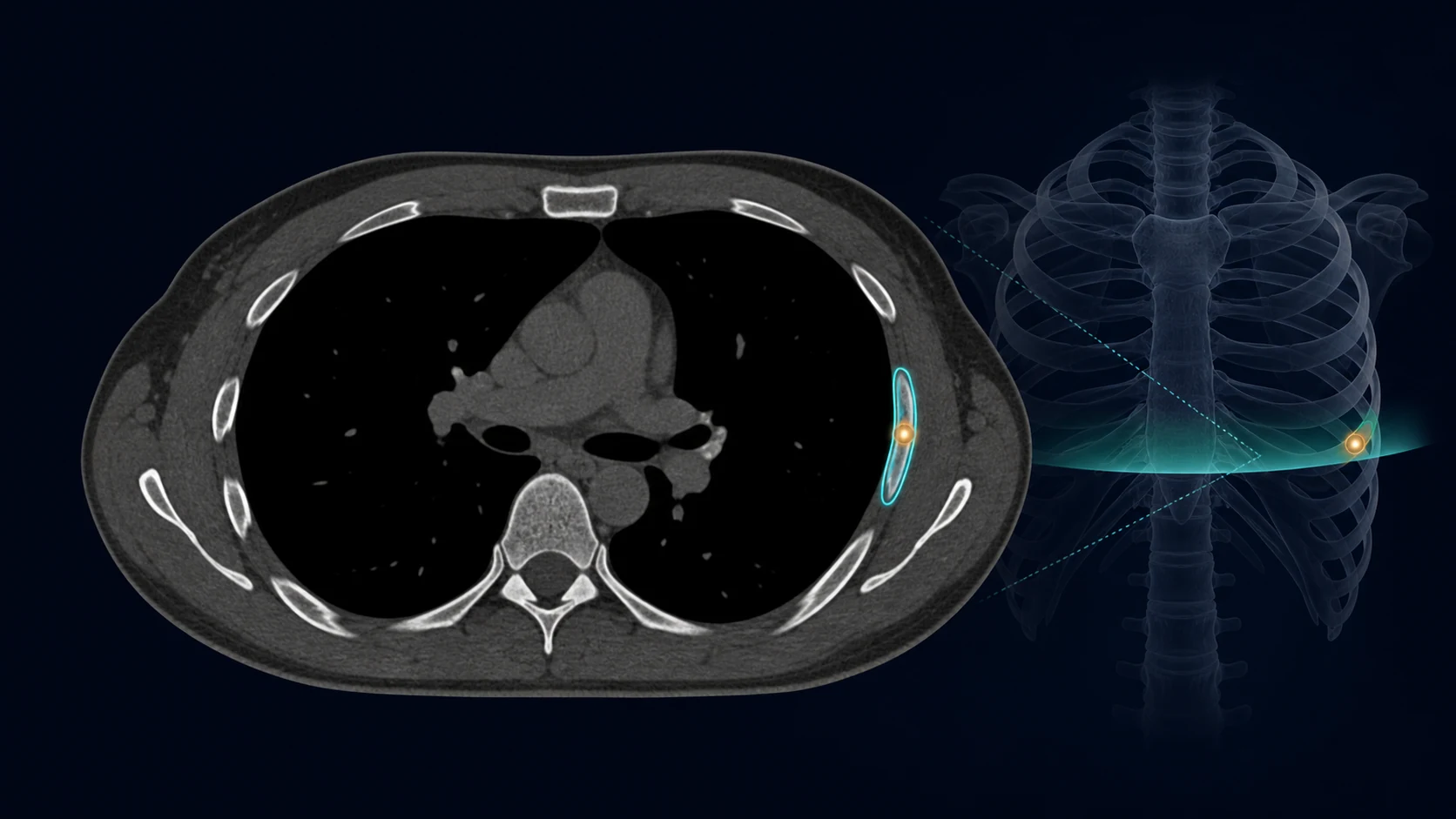 CT Bone fracture assessment workstation