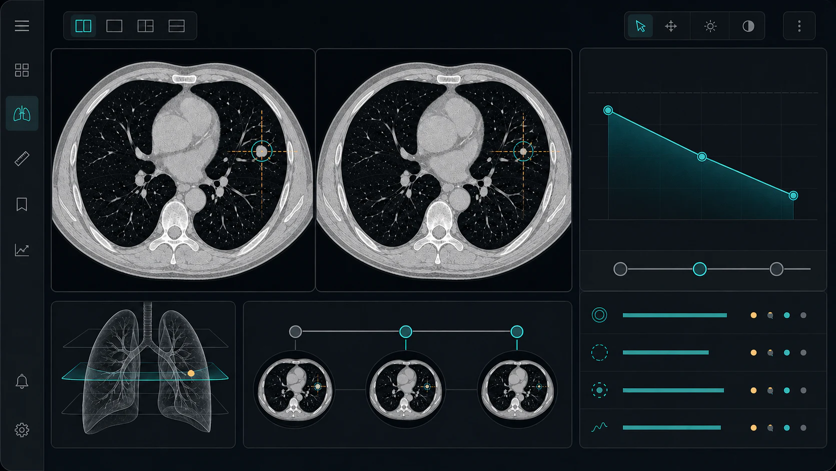 CT Lung longitudinal comparison workstation