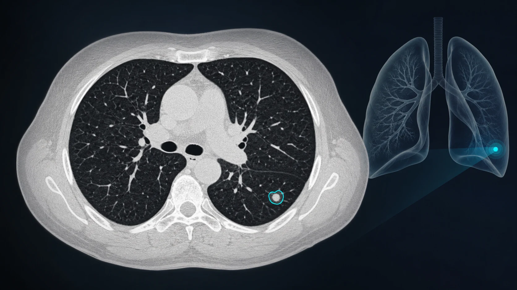 CT Lung analysis workstation