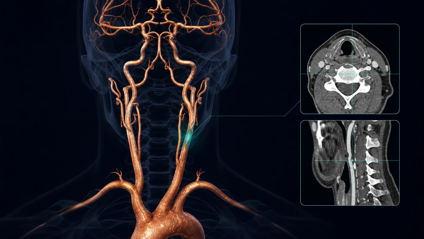Head and neck vascular AI workstation